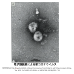 緊急ブログ　コロナウィルス感染 ー落ち着いて基本対応をー